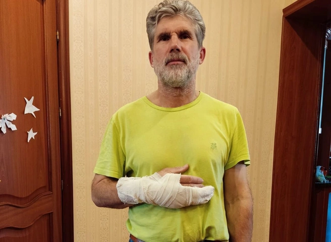 «Ударил и сломал руку». Рязанец заявил в полицию на тумского депутата от ЕР | ya62.ru