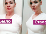 Тема раскрыта: редактор Woman.ru провела неделю с накладными грудными имплантами