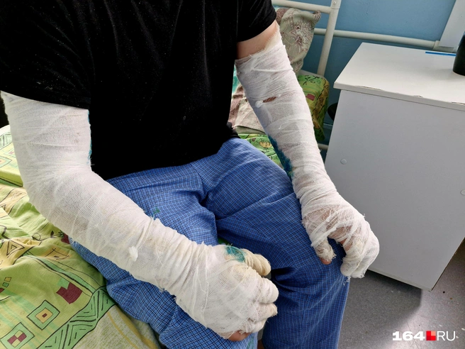Это не самое страшное, что можно увидеть в ожоговом центре | Источник: Виктория Федорова / 164.RU
