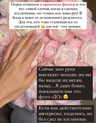 Зачем колоть в руки филлеры, как это делает Лена Перминова, — отвечает косметолог