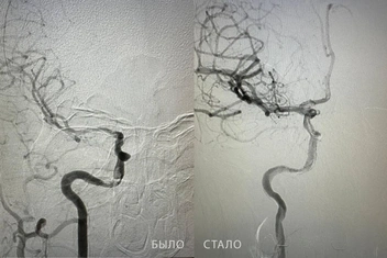 Источник: Департамент здравоохранения Тюменской области
