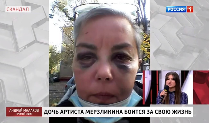Дочь Николая Мерзликина избил бездомный, которому она помогала