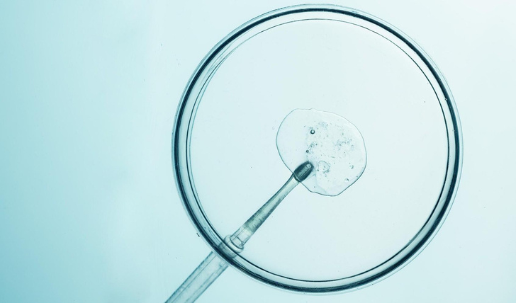 Вопрос эксперту: «Сколько будут храниться замороженные яйцеклетки, если я перееду в другую страну?»