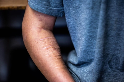 В Якутске 63 подростка пытались покончить с собой с начала года