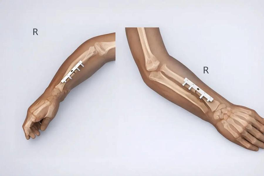 Ставропольские врачи спасли руку мальчика в Детской краевой клинической больнице