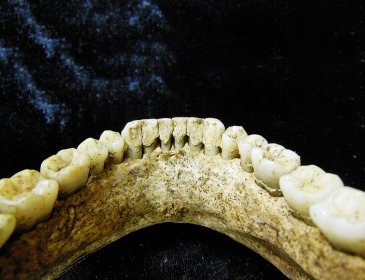 Давние связи: зубной камень из бронзового века