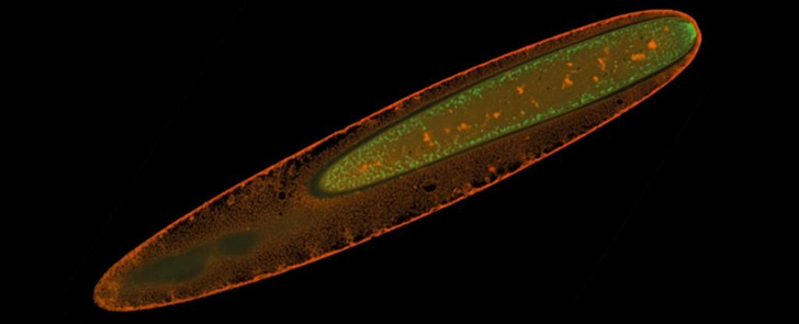 У видимой невооруженным глазом бактерии нашли невиданный тип обмена веществ