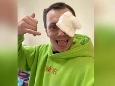 Бойцу ММА Корнею Тарасову, которого избила девушка, удалили травмированный глаз