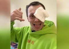 Бойцу ММА Корнею Тарасову, которого избила девушка, удалили травмированный глаз