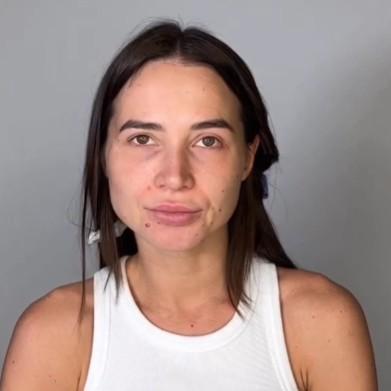 Кушанашвили оценил фото Лерчек из онкоцентра: «Чувак забрался на кровать сделать эффектный снимок угасающей супруги»