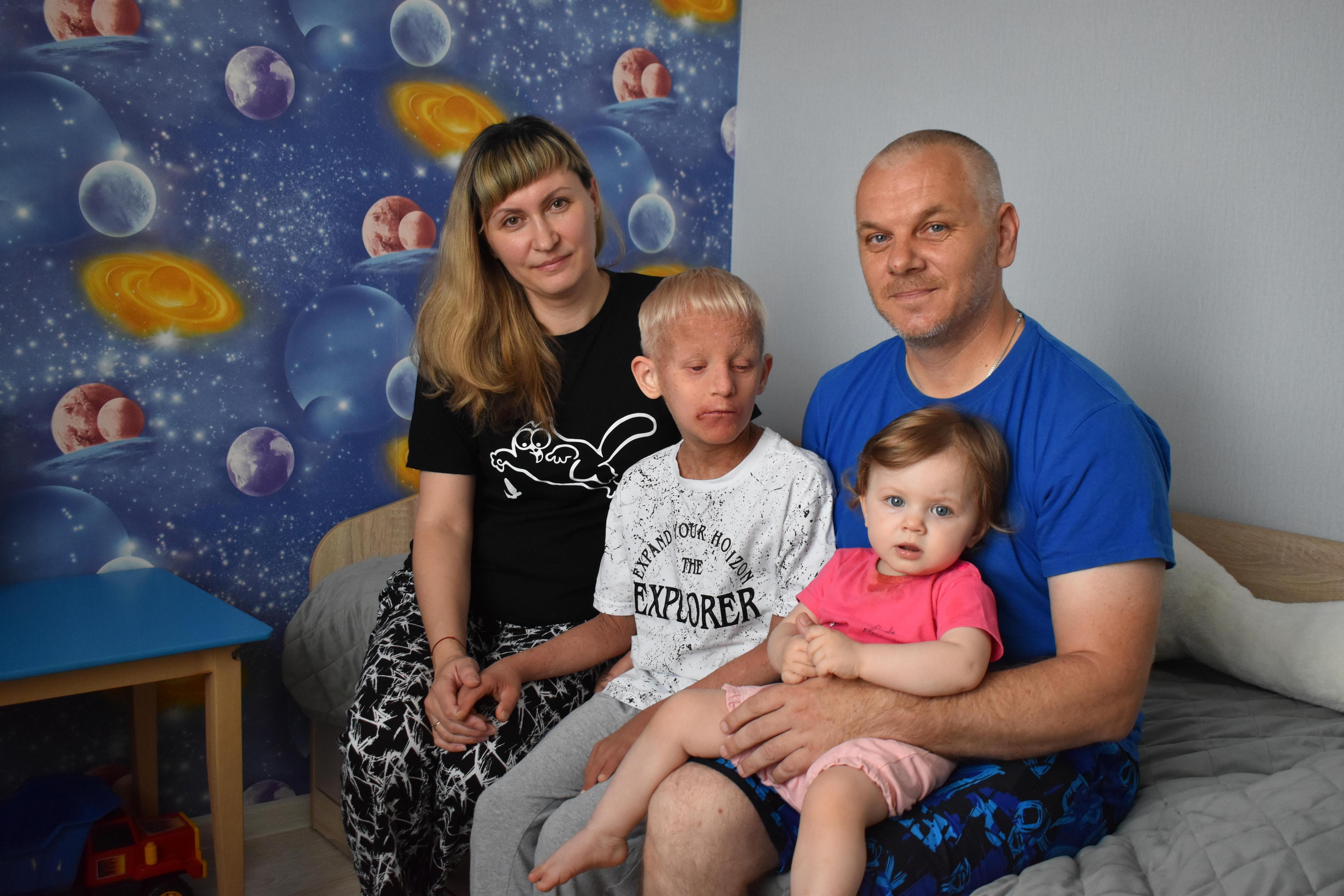«Ты только Диму не бросай». Как живет семья «мальчика-рыбки» из Сибири — уход за его кожей каждый день занимает 3 часа