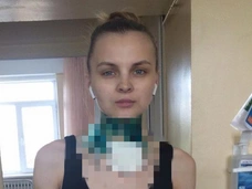 «Я захлебывалась кровью, а он кричал дочке: «Отвернись!»: звезды просят защиты для жертвы мужа-тирана