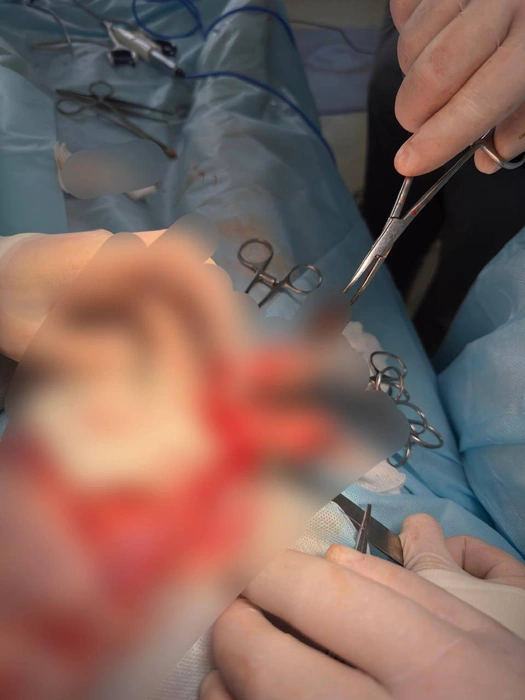 Мальчику провели операцию, теперь он идет на поправку | Источник: Детская краевая больница Ставрополя