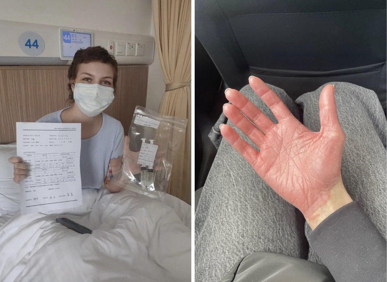 Выйти на улицу кажется огромным счастьем: 23-летняя студентка победила рак крови и теперь работает медсестрой в онкодиспансере