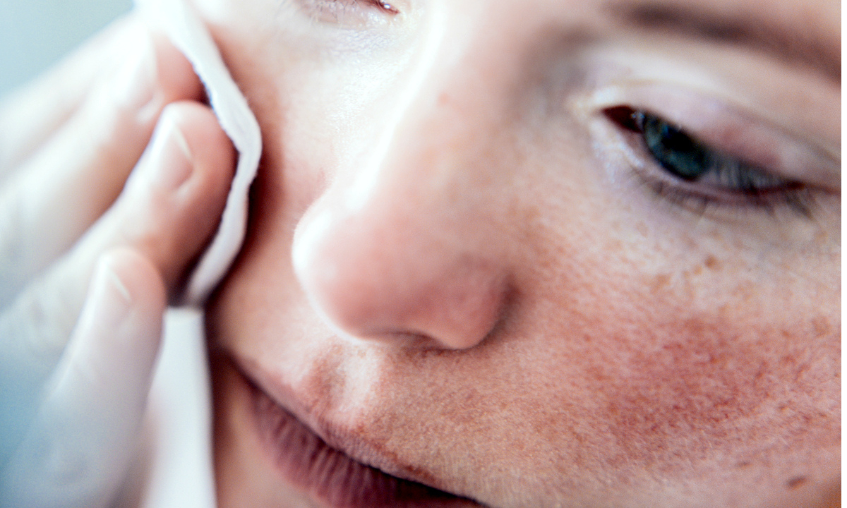 Что делать, если у тебя чувствительная кожа: 7 советов от дерматологов |  theGirl