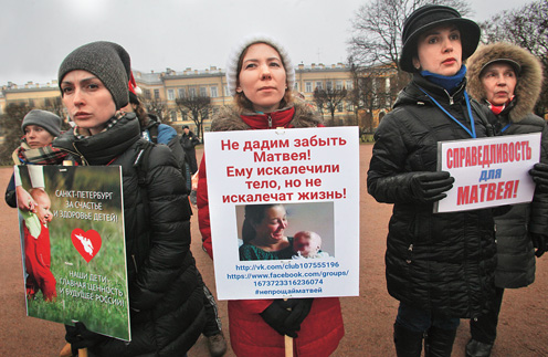 После происшествия медсестре, проводившей процедуру фототерапии, предъявляли обвинение в причинении тяжкого вреда по неосторожности. Но дело закрыли по амнистии к 70-летию Победы в Великой Отечественной войне | Источник: Интерпресс/PhotoXPress