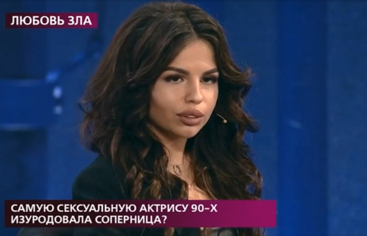 Наталья Лапина обвинила экс-возлюбленную бойфренда в нападении с кислотой