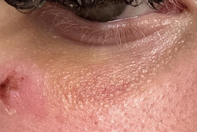 Следствие проверяет организаторов квеста после травмы девушки