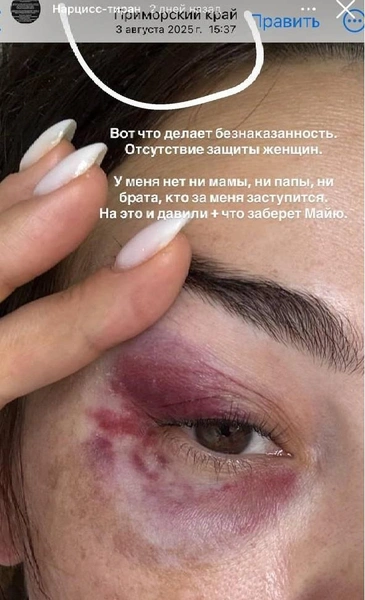 Источник: __angelna.g / instagram (экстремистская организация, деятельность запрещена на территории РФ)