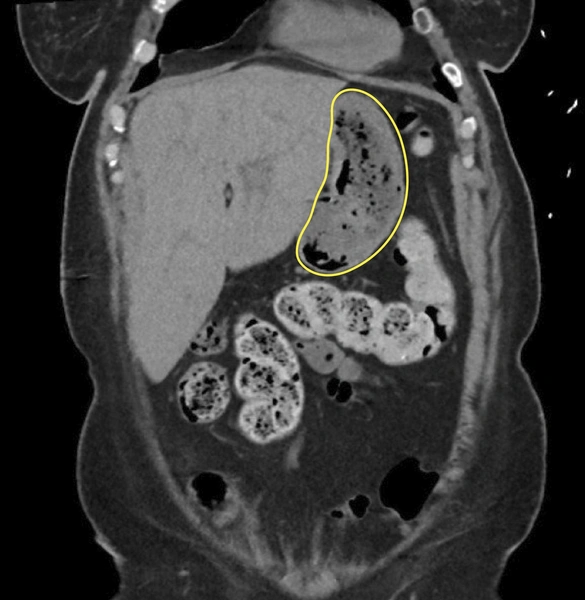 Источник: www.nejm.org