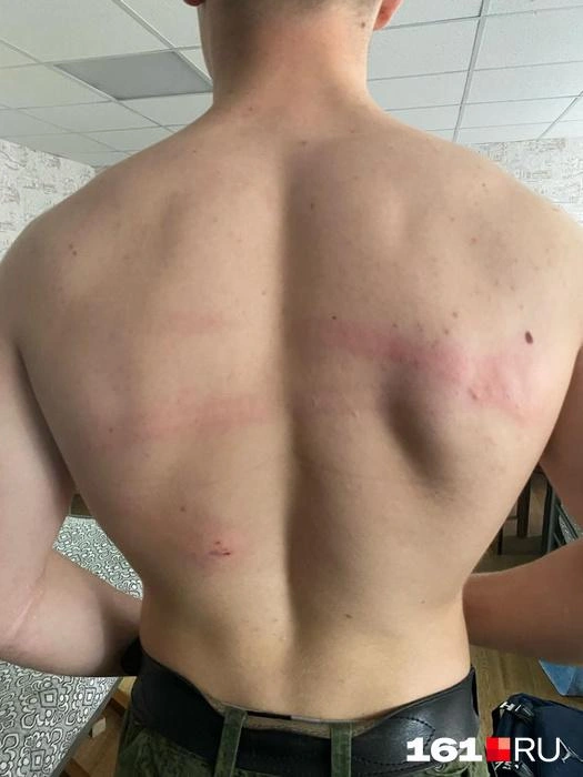 Фотографии после избиения сохранились в телефоне у парня | Источник: предоставлено героем публикации
