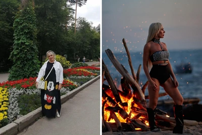 Siberian Woman's Weight Loss and Plastic Surgery Journey