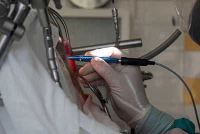 В Иркутске удалили опухоль из мозга ребенка в уникальной операции