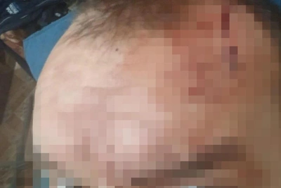 Ex-Police Officer Beats Two with Club in Ilovlya