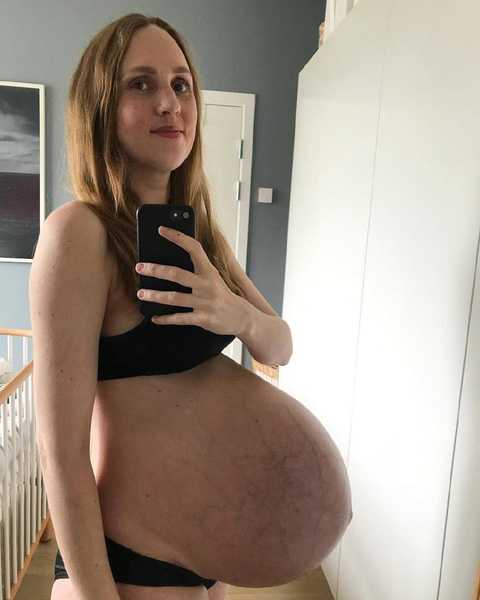 Мама тройни выглядит беременной даже через 3 месяца после родов