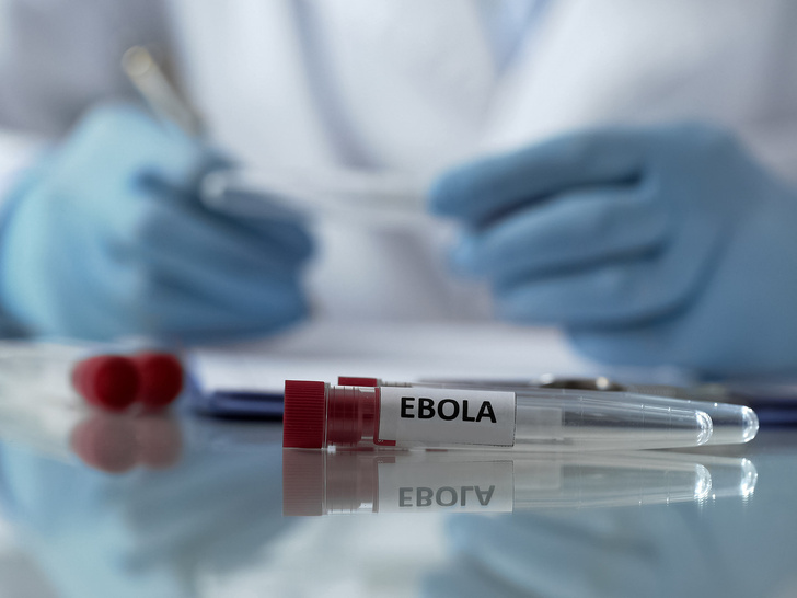 Новая опасность: 5 первых симптомов лихорадки Эбола, о которых вам нужно знать