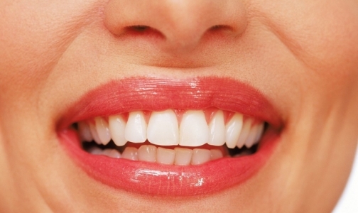 Всегда ли хорошо делать желтые зубы белыми?