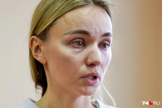 Рубцы на лице были выражены сильнее, сгладить их помогли врачи | Источник: Михаил Шилкин 