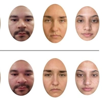 Диагноз по фотографии: женщины лучше вычислили больных по лицу