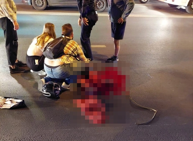 Очевидцы опубликовали фото с пострадавшим на улице Ленина мотоциклистом | ya62.ru