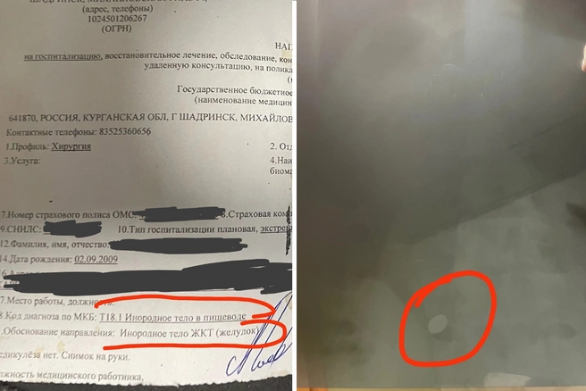 Поход к стоматологу пошёл совсем не по плану для зауральского подростка | Источник: ШАДРИНСК РЕГИОН 45 / Vk.com