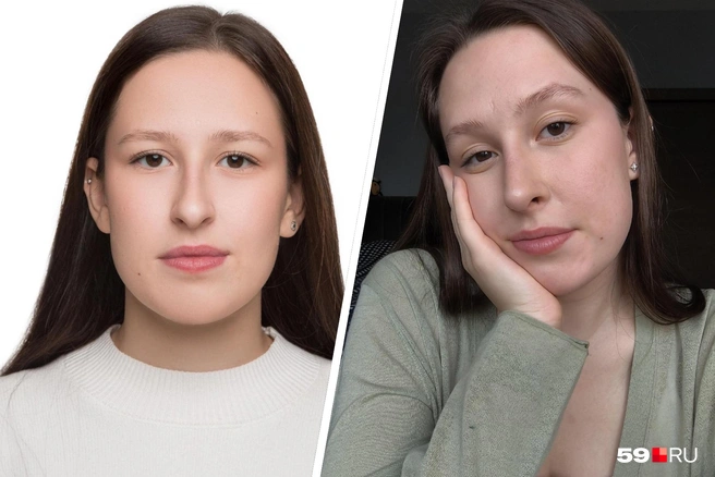 Анастасия сделала риносептопластику и довольна результатом | Источник: Анастасия Селиверстова / 59.RU