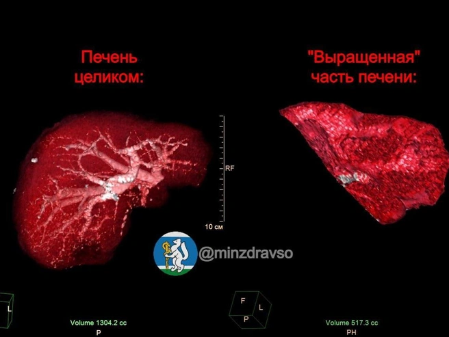 Источник: Министерство здравоохранения Свердловской области 
