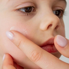 «Мама, чешется!»: как помочь коже ребенка пережить сезон холодов и отопления