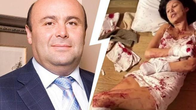 Напал на бывшую с топором: «оружейный барон» Хубутия сознался в жестоком избиении Юлии Ван
