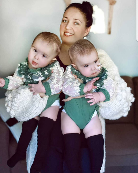 Мама успешно разделенных сиамских близнецов ждет еще одного ребенка