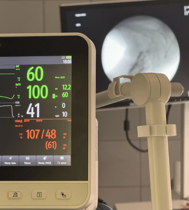 Во время операции врачи чутко следят за состоянием пациента | Источник: «Сова»