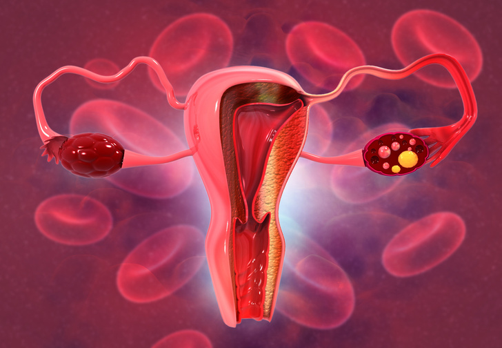 Обильное кровотечение при менструации и его причины