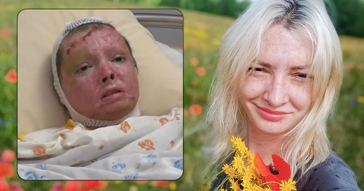 Ревнивая жена, которая подожгла любовницу мужа, попросила у нее прощения в суде