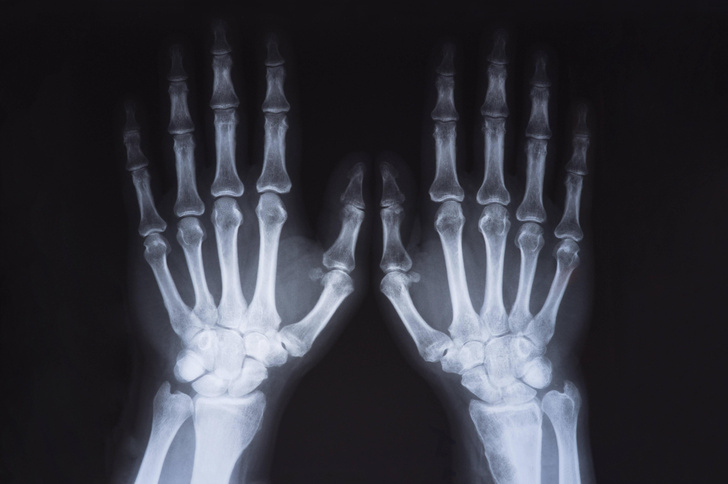 Как часто можно делать рентген?