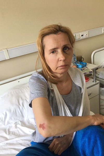 После жестокого избиения Людмила Мосейко несколько недель провела в больнице