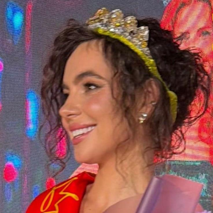 Лицо «Автоледи Кирова — 2026» Надежды Шустовой изуродовали осколком стекла на концерте «Тату» в Казани