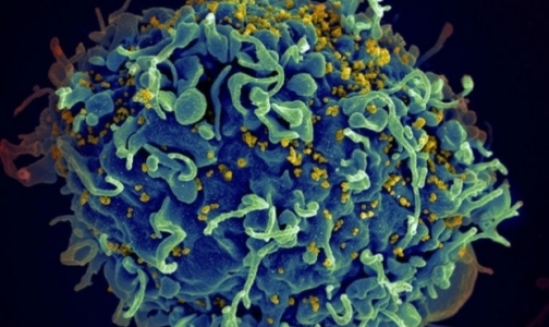 Скворцова: Россия разработает вакцину против ВИЧ к концу 2014 года