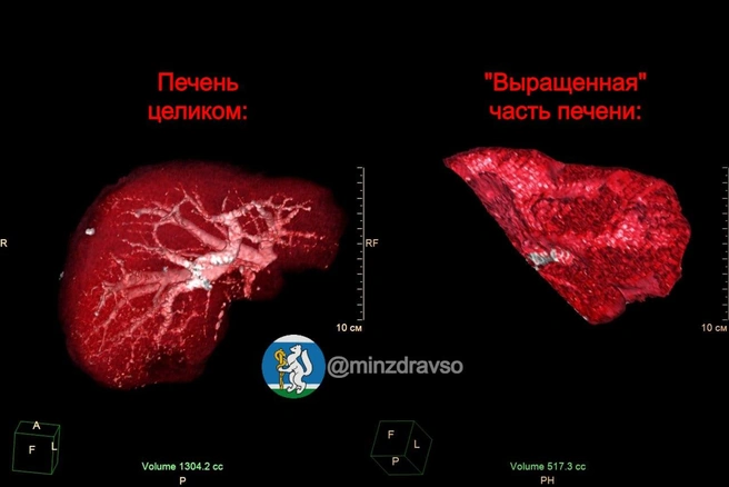 Источник: Министерство здравоохранения Свердловской области 