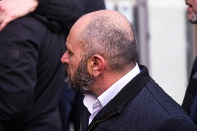 Трихолог: облысение не связано с тестостероном