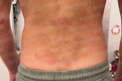 Ударник Михайловского театра описал драку в ресторане